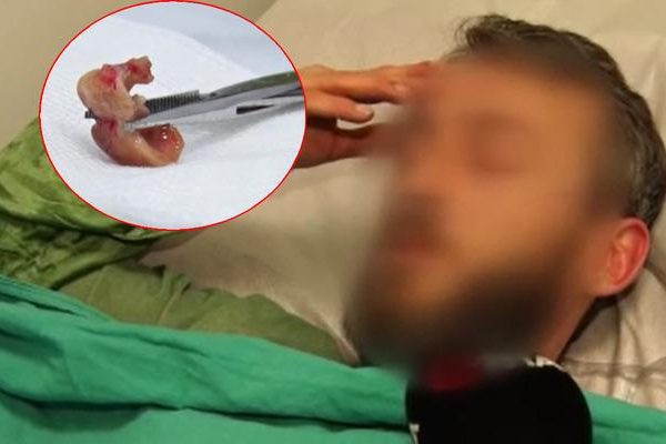 Aynaya baktığında şok olan uykudan dayanılmaz öksürük ile uyandı! Geceleri uyurken ilginç olay oldu