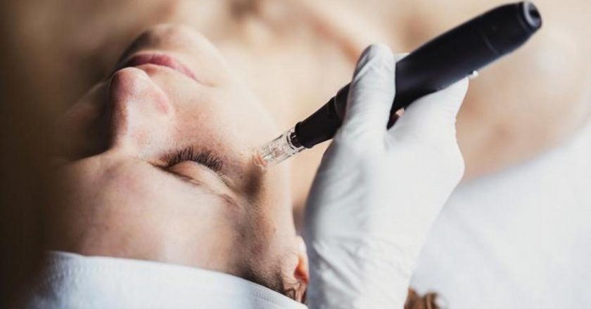 Dermapen nedir, ne yapar? Dermatpen tedavisi nasıl uygulanır?