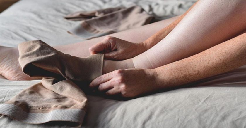 Lipodema (ağrılı selülit) nedir? Tedavi semptomları ve yöntemleri nelerdir?