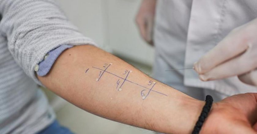 Hangi doktor alerjik teste gidebilir? Alerji testi hangi bölüme benziyor?