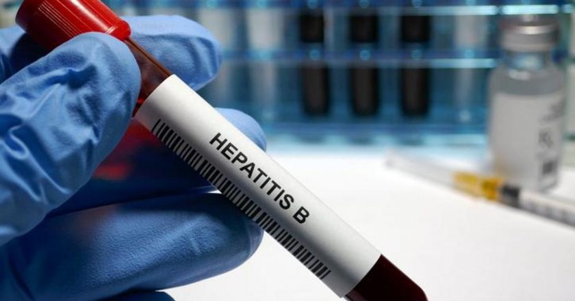 Hepatit B semptomları nelerdir? Hepatit B Nasıl Anlaşılır? Tedavi yöntemleri nelerdir?