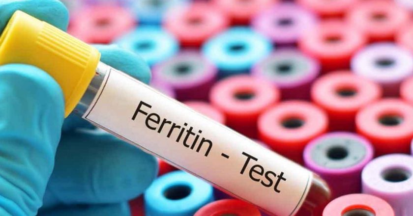Ferritin eksikliği nedir? Ferritin eksikliğini nasıl geçersiniz?