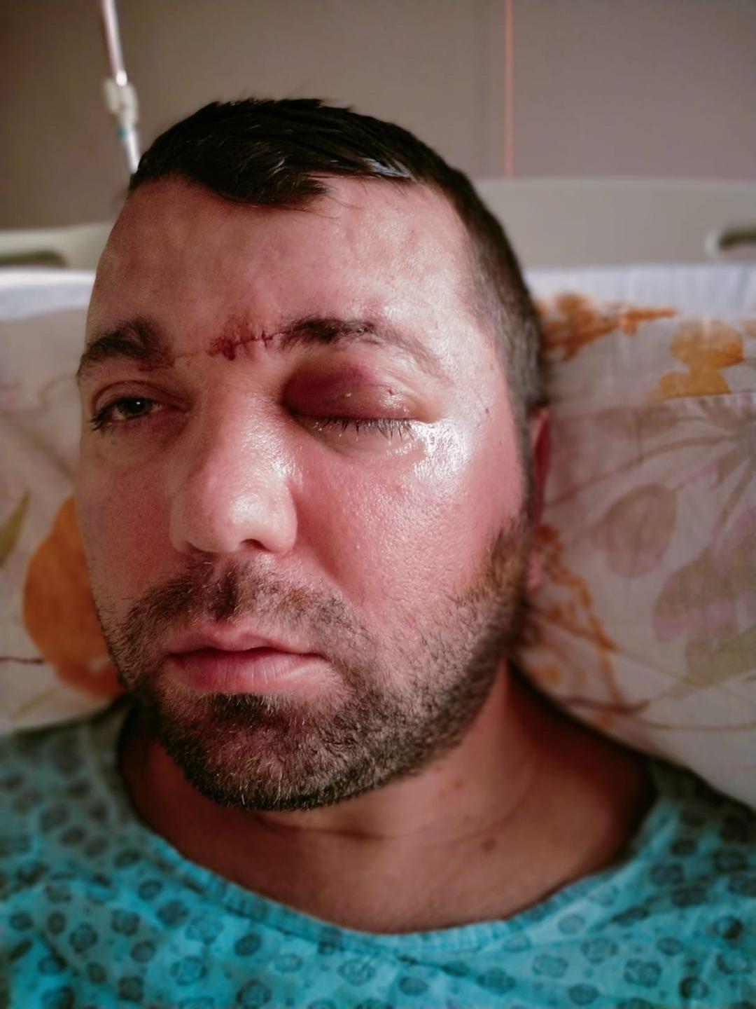 Bursa'da inanılmaz olay: Dişçiye gitti, hayatı kabusa döndü! Neredeyse ölüyordu 4