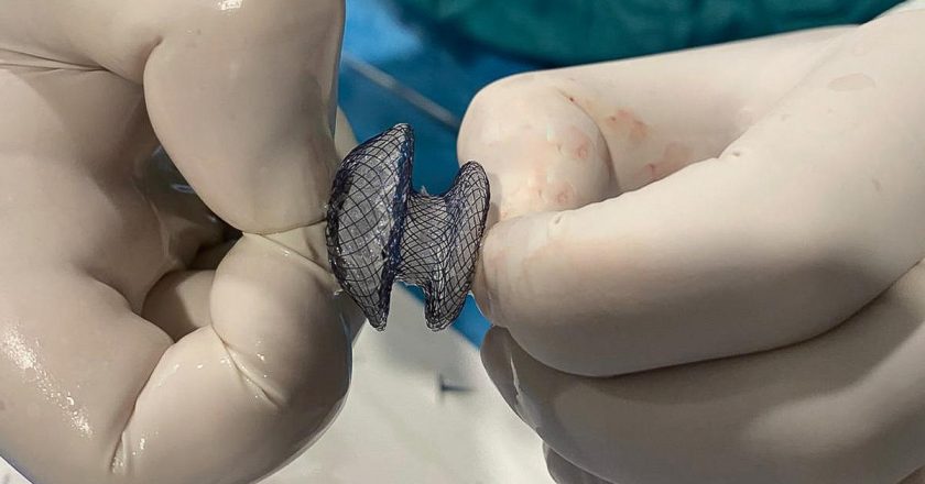 Çarpıntı, nefes darlığı ve yorgunluk şikayetiniz varsa dikkatli olun! Kalp deliği artık kapalı yöntemle tedavi edilebilecek